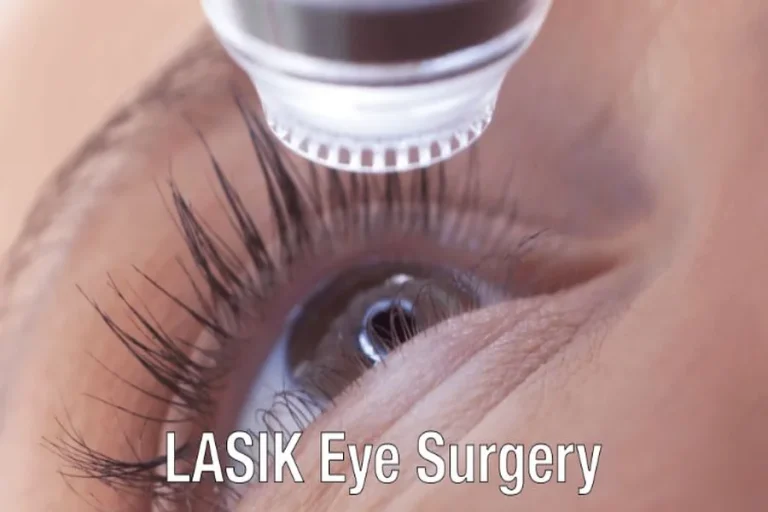 LASIK Eye Surgery