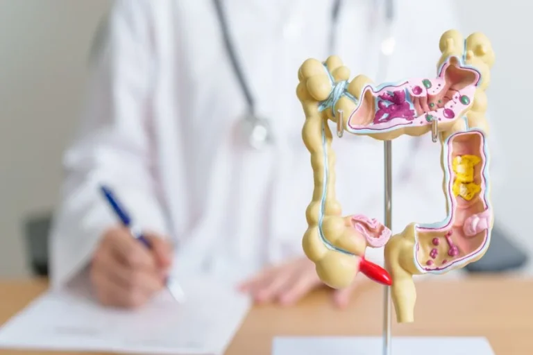Colonoscopy