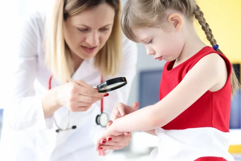 Top 5 Skin Conditions a Kids Skin Doctor Treats