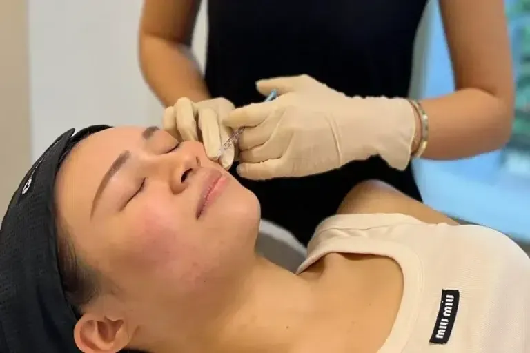 Acne Clinic Singapore