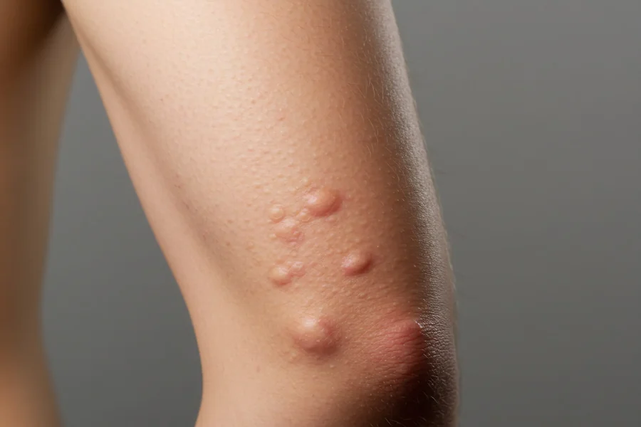 Dermatologist Singapore